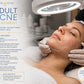 Adult Clean Acne Treatment