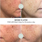 VISO - FDA Certified Red Light Therapy Mask